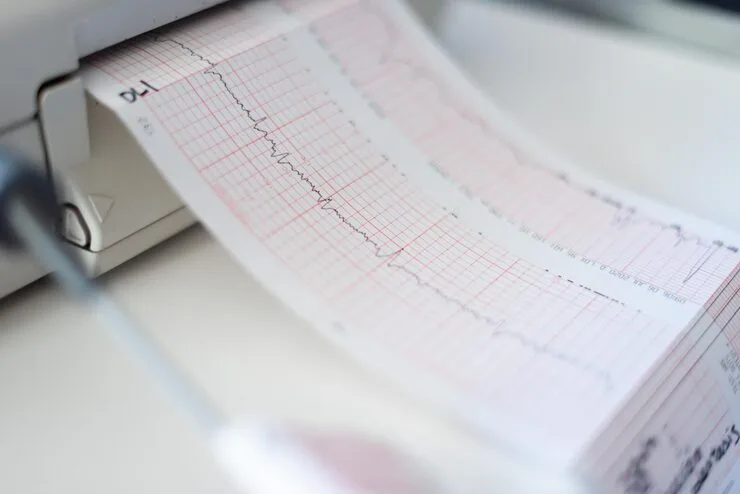 eletrocardiograma para cães com sopro